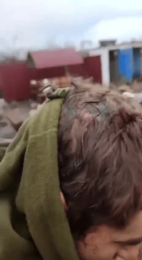 烏克蘭士兵頭部僅擦傷。