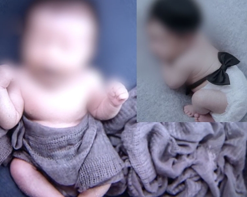 男嬰拍攝藝術照後感染肺炎。(網圖)