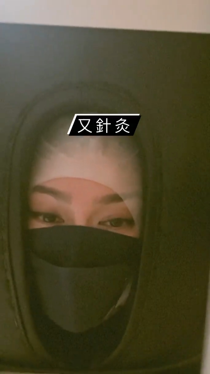 要做針灸。
