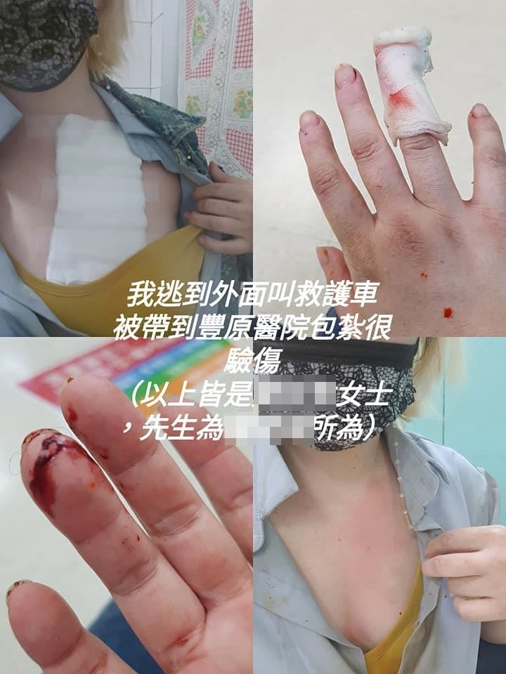 前空姐傷勢。爆料公社FB圖片