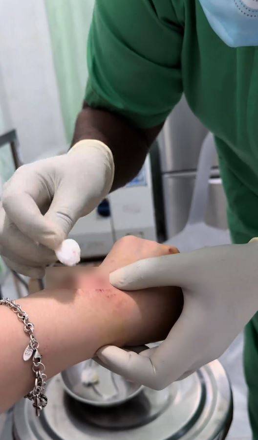 內地女遊客「大姨媽」到仍潛水，疑血腥味刺激鯊魚，導致手部被咬出血洞。抖音＠我愛藍色