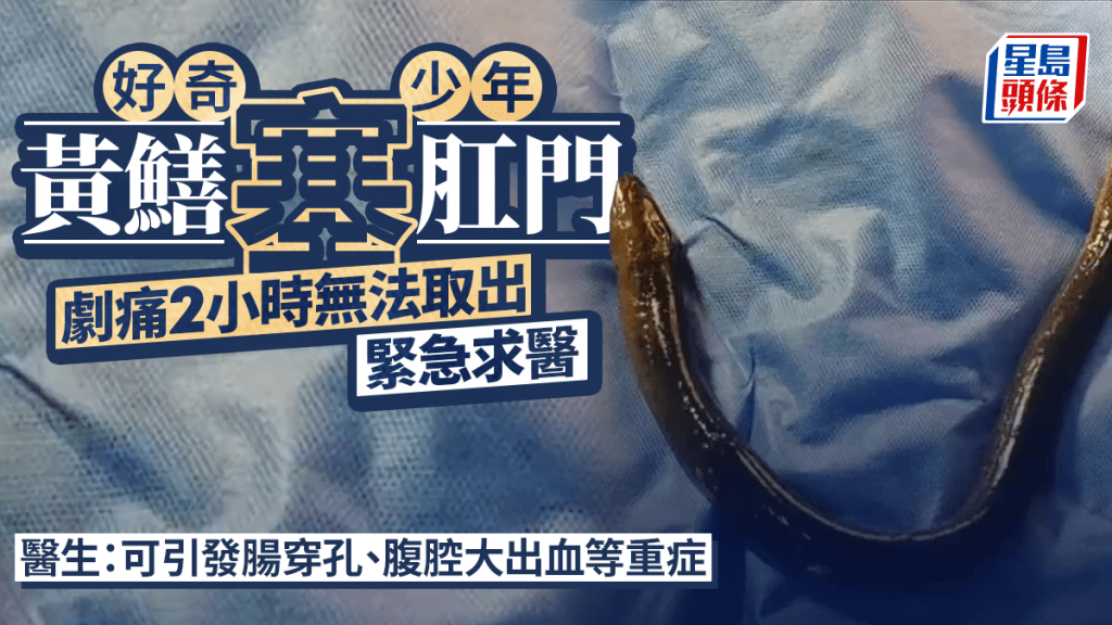 肛門塞活黃鱔｜14歲少年劇痛2小時無法取出 緊急送院求醫
