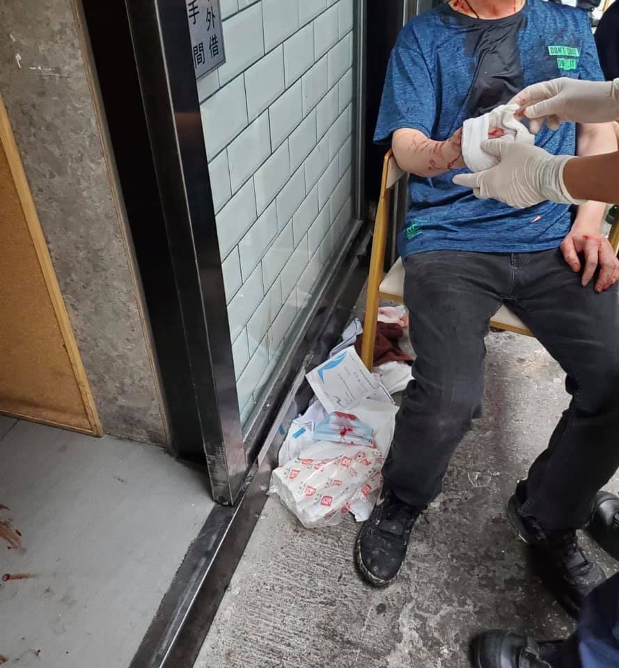 廚師右手被玻璃碎片割傷，即場包紥。龍門冰室FB圖片。