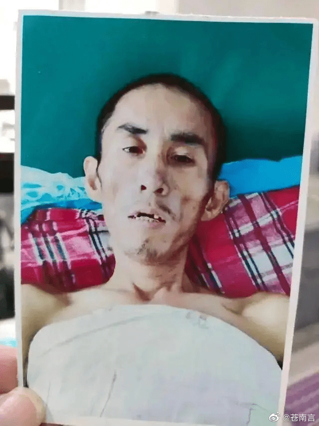 因身懷逃犯身份證，安徽省利辛縣一名智障男子李四強坐冤牢9年，出獄2月後離世。