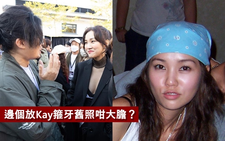 Kay被翻「黑歷史」箍牙舊照。