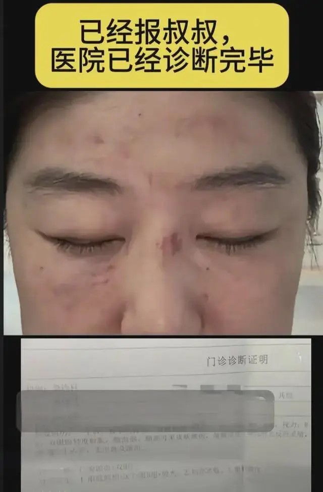 李雨禪到車厘子市集「踩場」與人衝突被打。 李雨禪到車厘子市集「踩場」與人衝突被打。