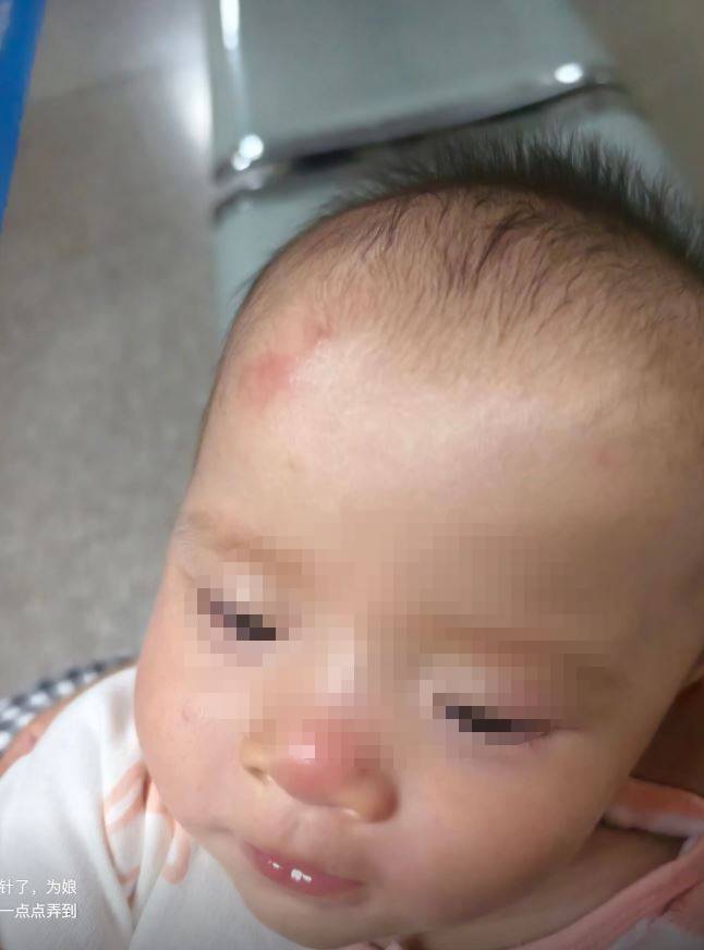 「洢諾」女兒被撞至滿頭傷。抖音