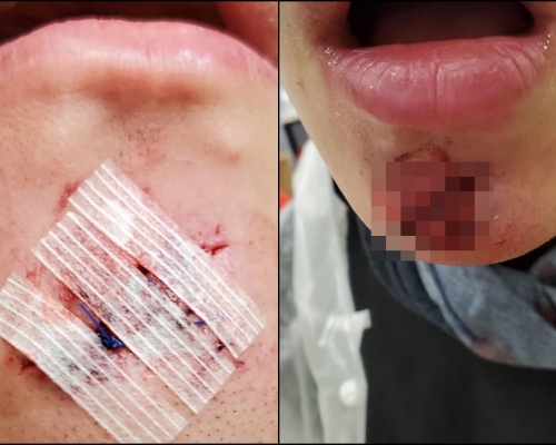 香港恒生大學學生會編輯委員會FB圖片。