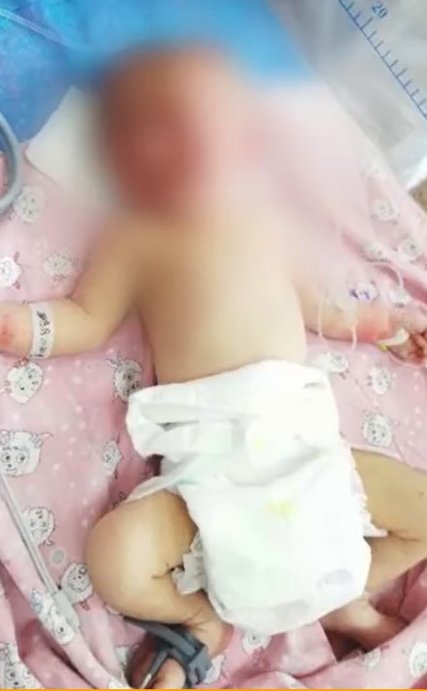 經治療,目前女嬰生命體徵平穩。