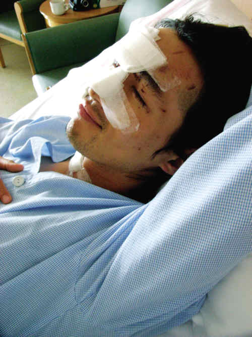 胡歌2006年8月在横店往上海途中发生严重车祸。（网上图片）
