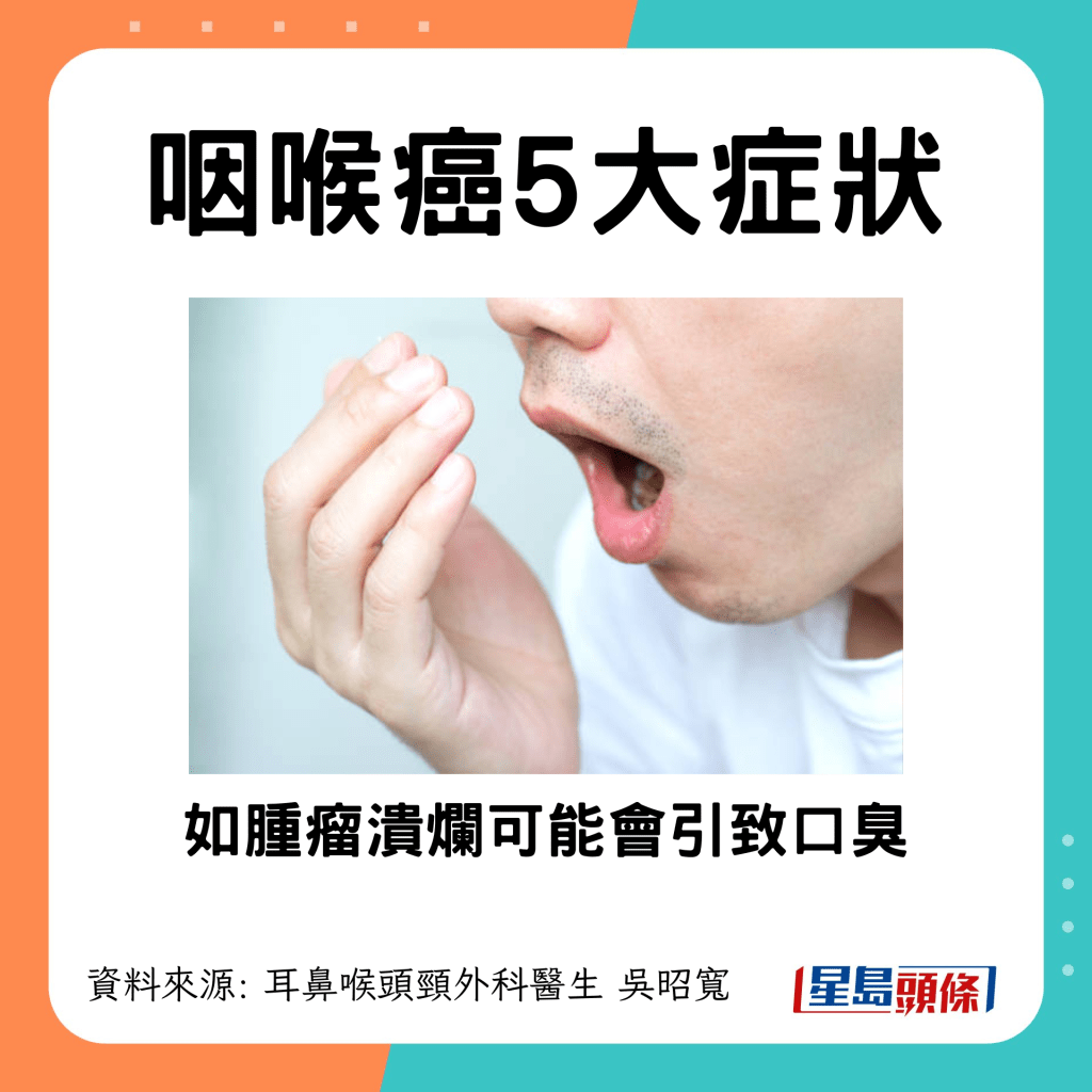 咽喉癌5大症狀：如腫瘤潰爛可能會引致口臭