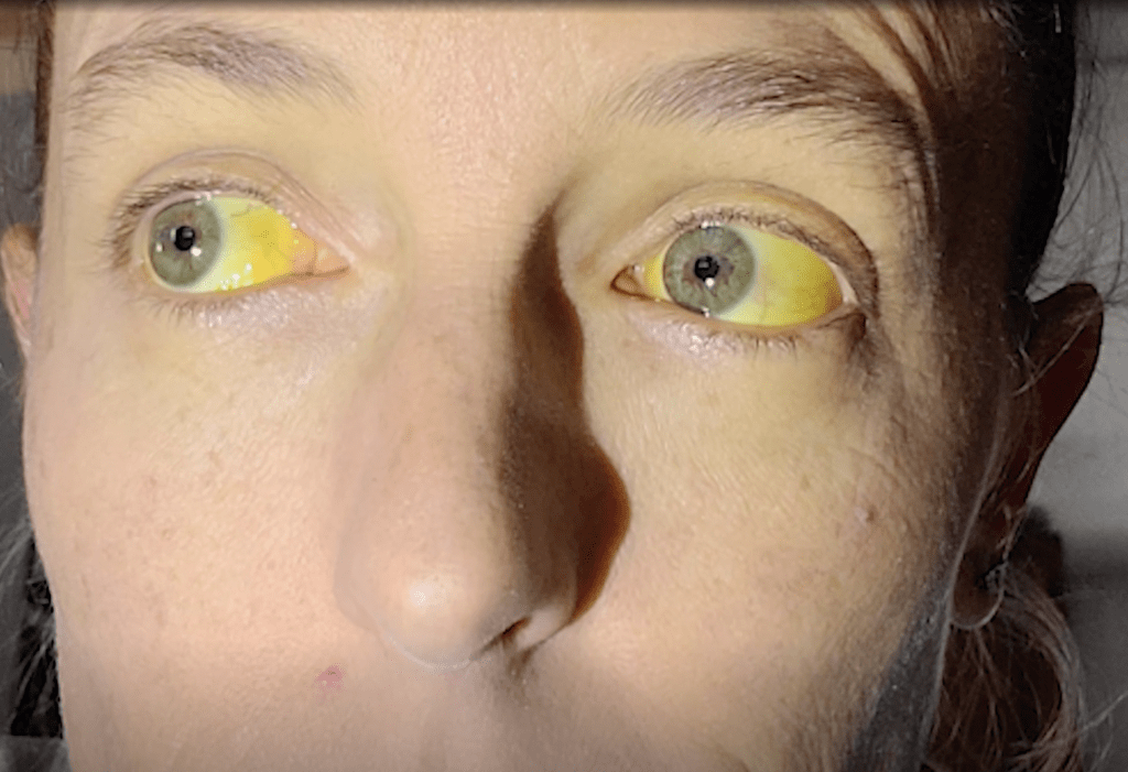 安柏的“莹光黄”双眼十分吓人。