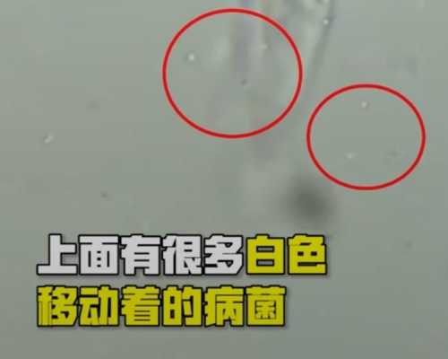 顯微鏡放大2000倍的口罩,可看到有細菌在移動。網圖