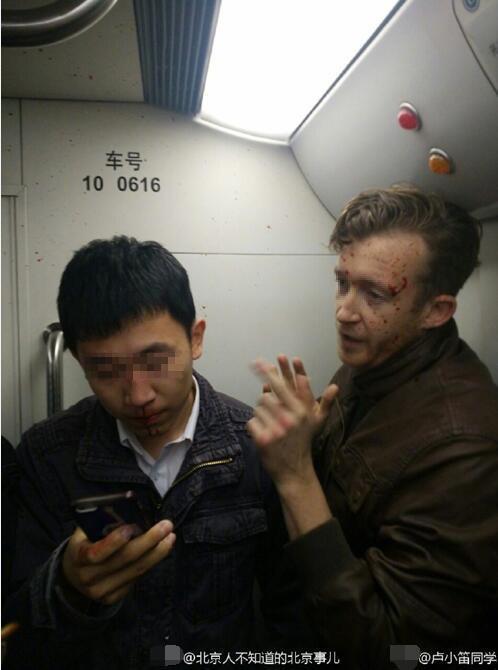 網民反應兩極,有人質問為何不還手,但亦有認為「還手贏了坐牢,輸就住醫院」。