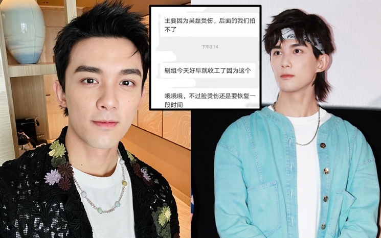 吳磊傳臉部燙傷恐毀容。