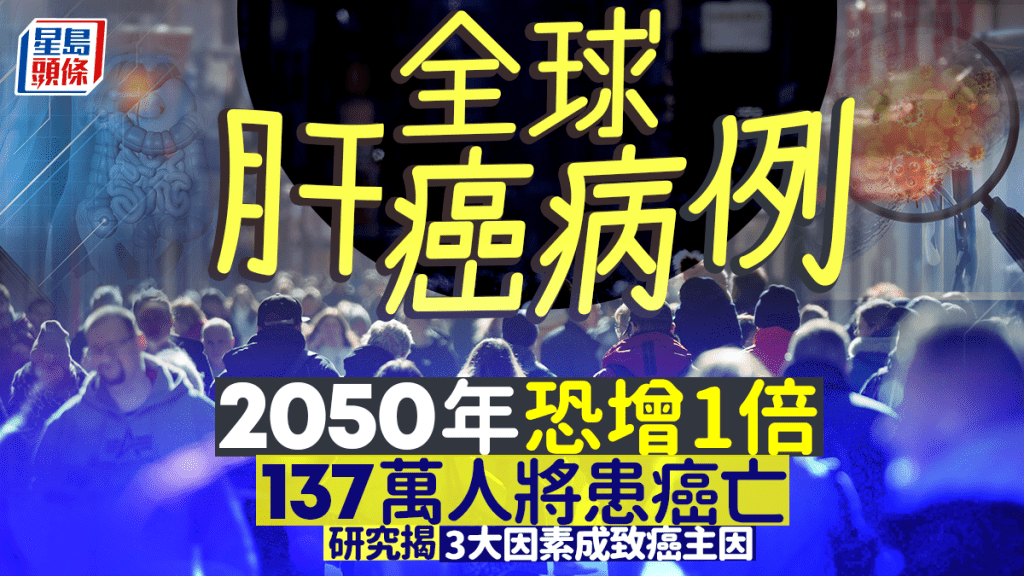 全球肝癌病例2050年恐增1倍 137萬人將患肝癌亡 研究揭3大因素成致癌主因