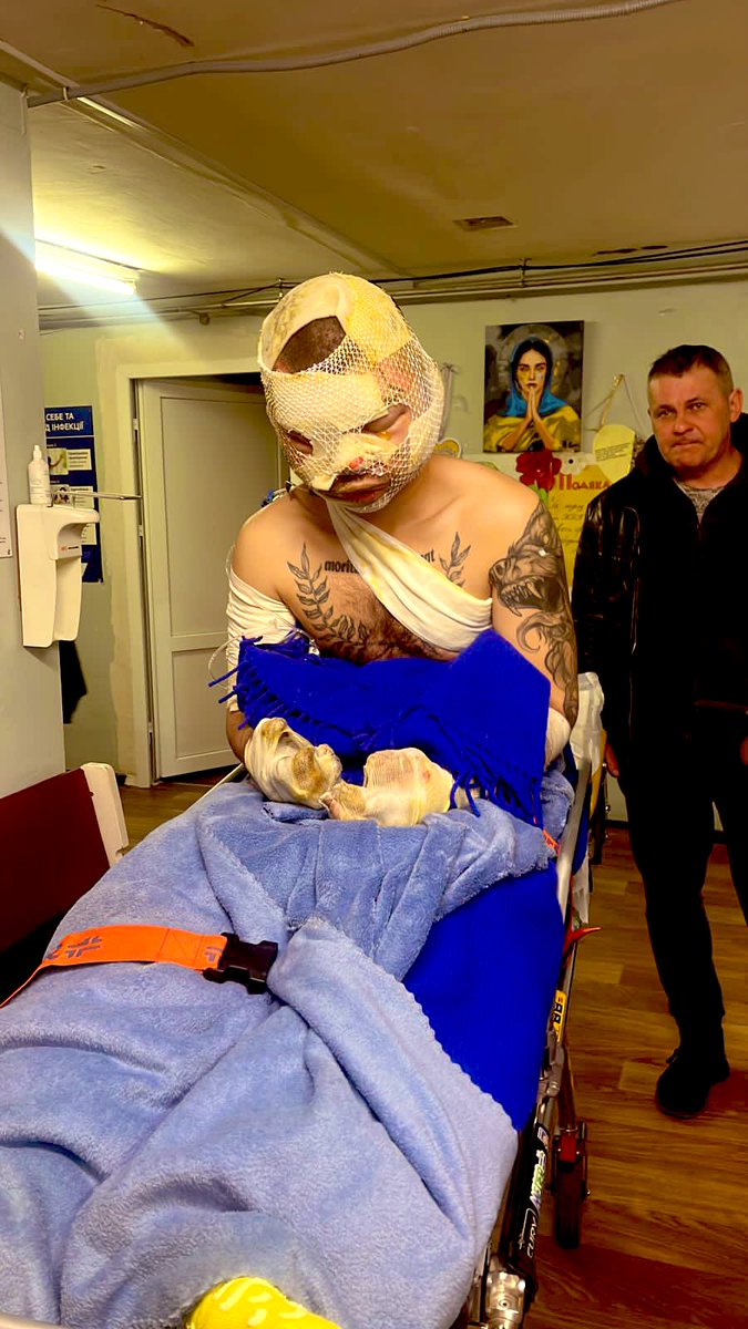 網傳烏方化武受害者的傷勢照片。 X
