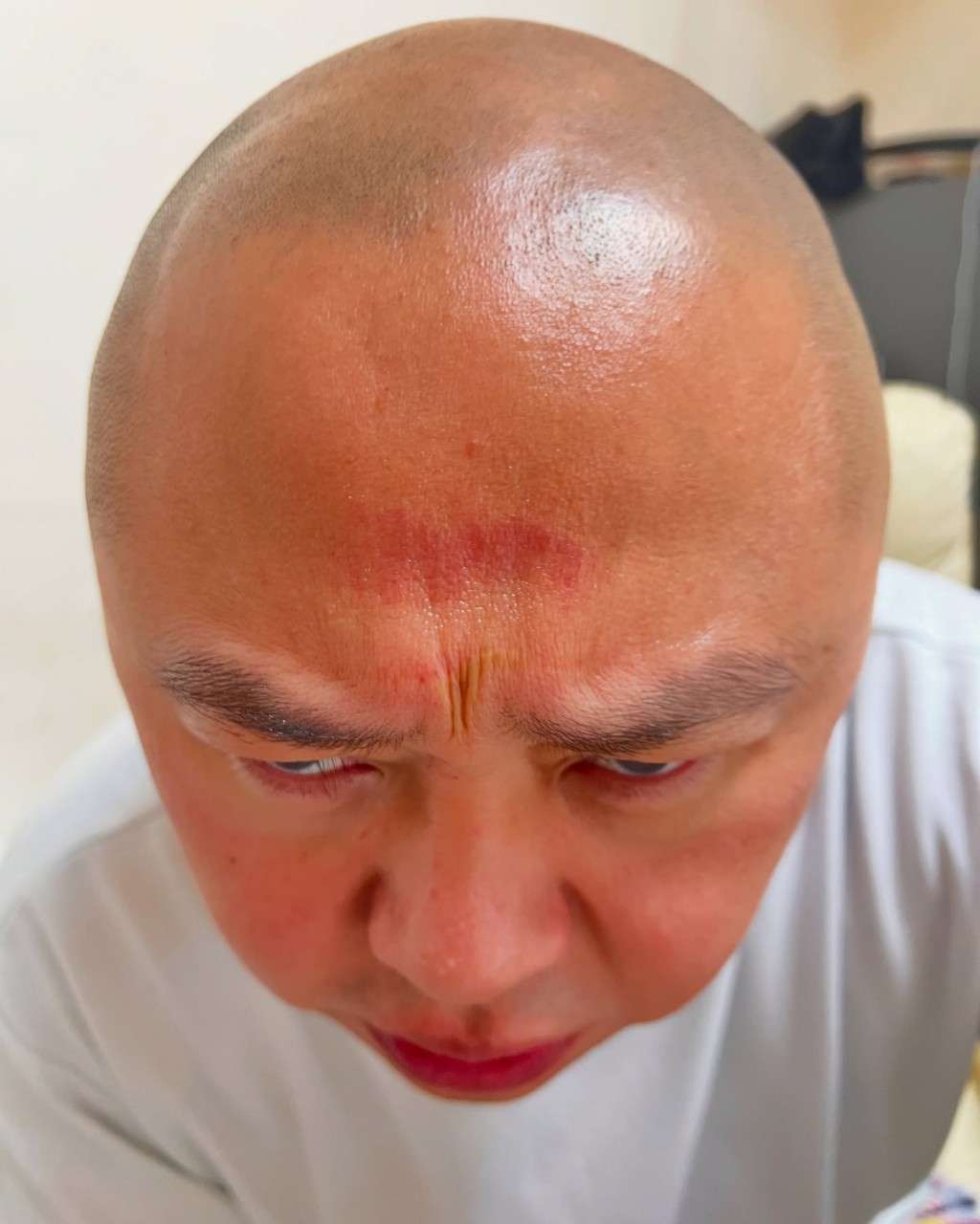 Bob一身傷痕。 Bob一身傷痕。