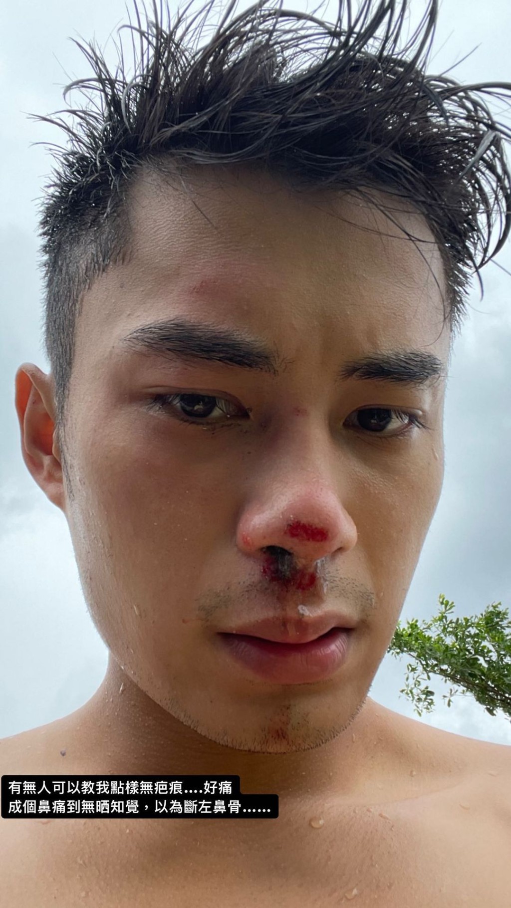 Danny踩單車為避小朋友，意外仆崩鼻。