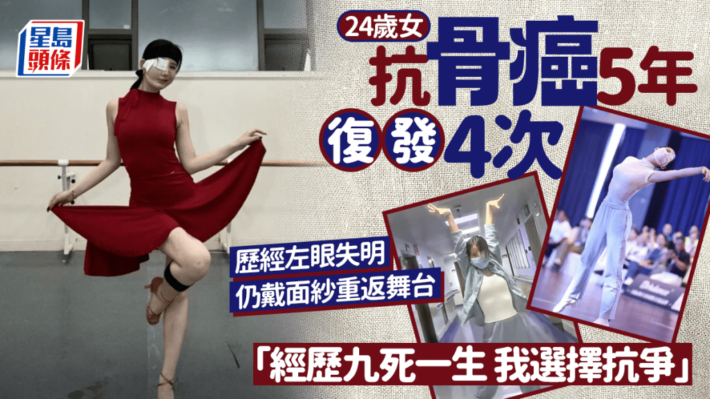 24歲女抗骨癌5年復發4次 慘歷經左眼失明徘徊生死邊緣 仍戴面紗重返舞台：經歷九死一生 我選擇抗爭