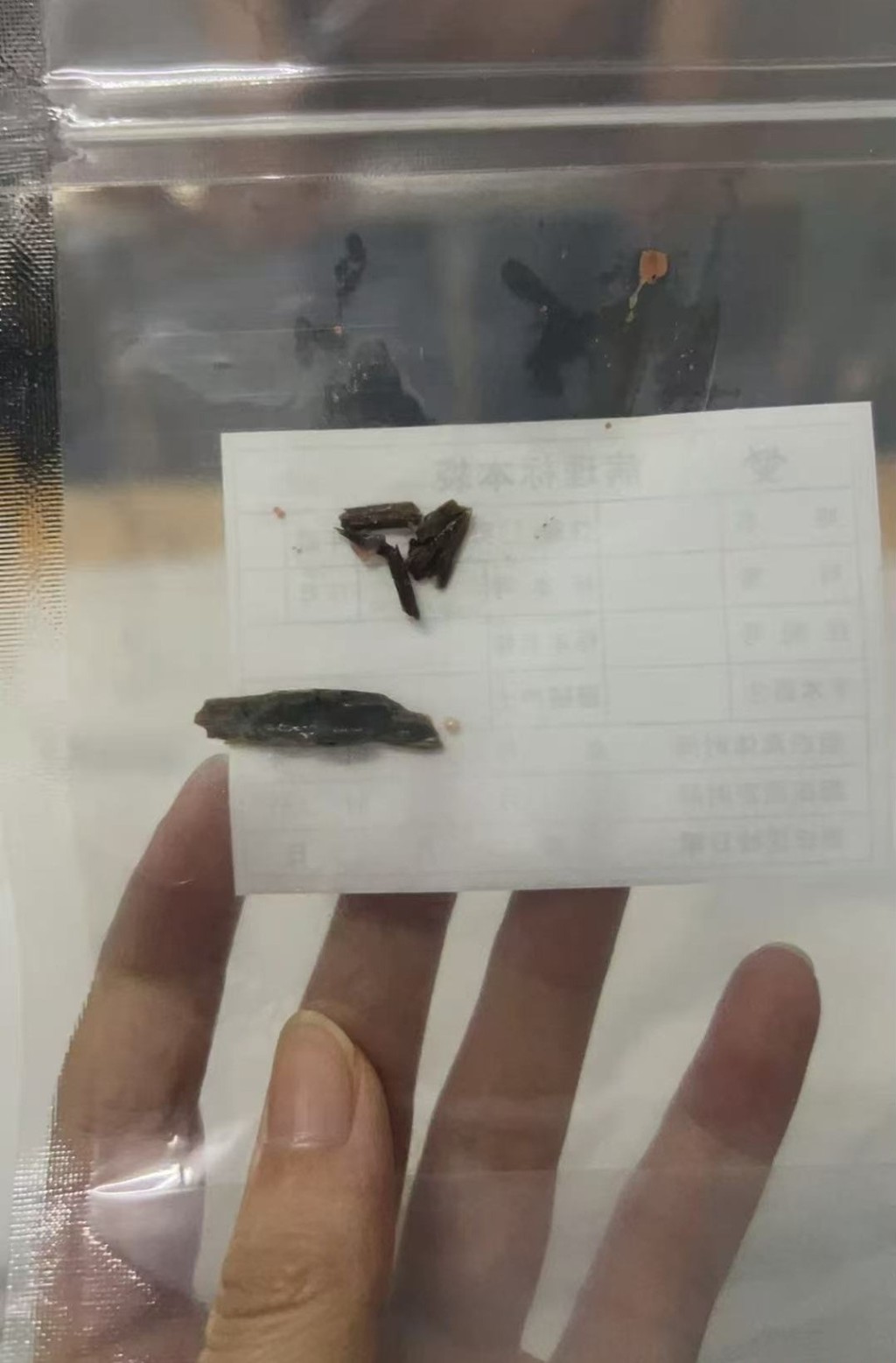 李小姐被竹籤插入肌肉內16年也不知,造成長期腳痺疼痛。三湘都市報 李小姐被竹籤插入肌肉內16年也不知,造成長期腳痺疼痛。三湘都市報