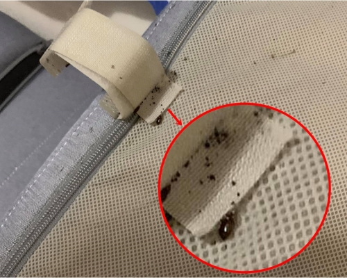 港媽早前發現外傭因買二手衫而導致家中出現大量床蝨。FB群組「香港僱主討論區」圖片