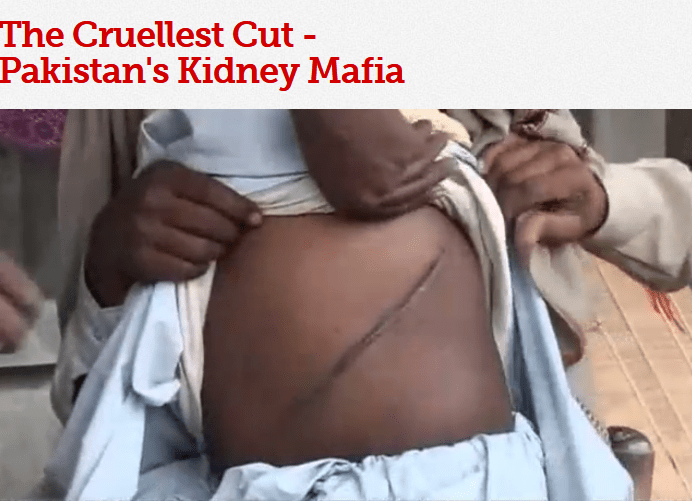 巴基斯坦活摘腎臟的集團猖獗。網上圖片