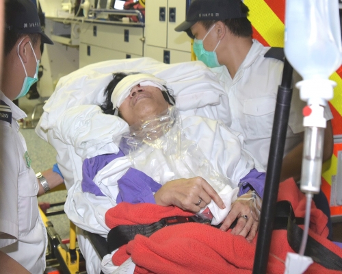 熟睡婦人懷疑遭智障妹挖甩眼球。