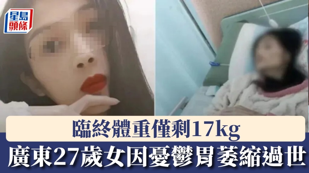 廣東27歲女因重度憂鬱，胃萎縮過世，臨終體重僅剩17kg。