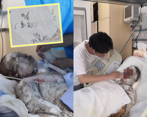 店主夫婦被燒致重傷。網圖