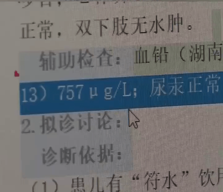 女童的血鉛達到每升757微克。