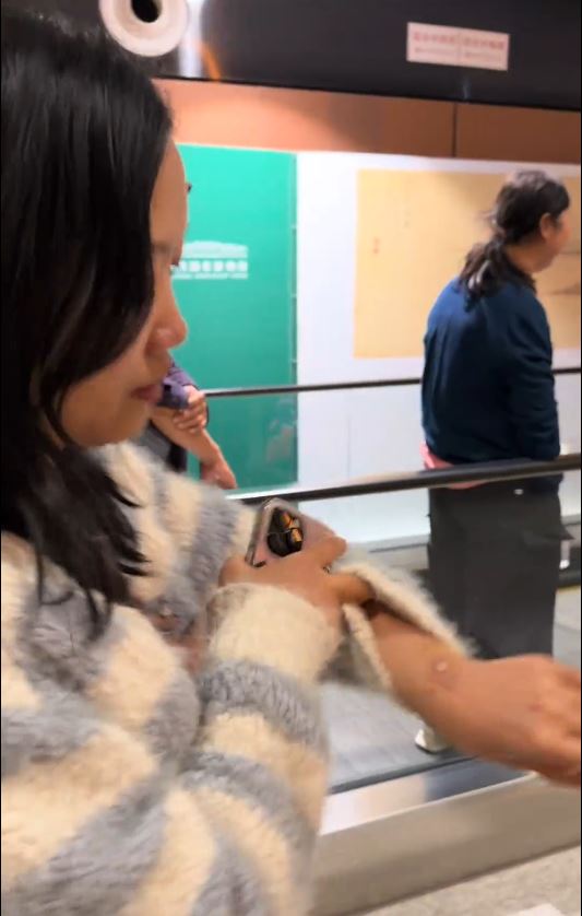 內地女遊客「大姨媽」到仍潛水，疑血腥味刺激鯊魚，導致手部被咬出血洞。抖音＠我愛藍色