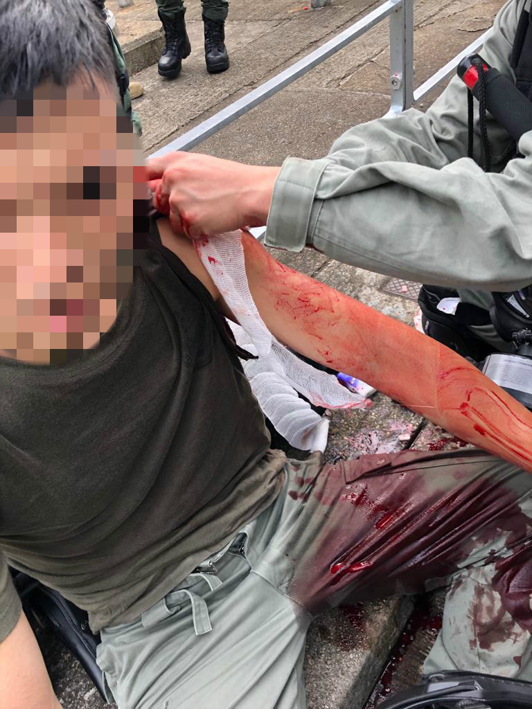 政府譴責故意嚴重傷害警務人員身體。