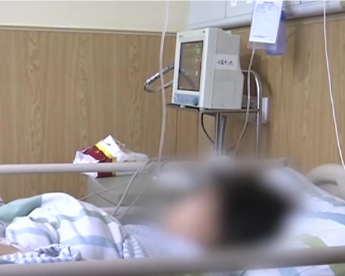 一名12歲的少女因肚子脹痛和脫水被送進醫院,醫生診斷為腸梗阻,手術時竟從胃內取出一團頭髮。(網圖)