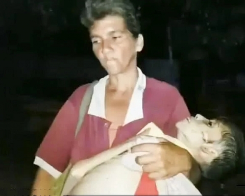 一位媽媽抱着嚴重營養不良女兒屍首到殮房。(網圖) 