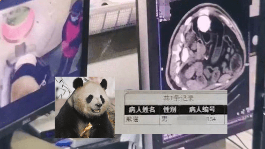 患者「熊貓」照CT惹關注 「七七」突發腸梗阻要做手術
