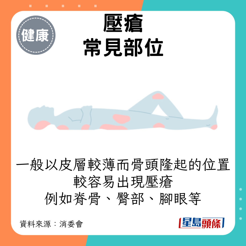 一般以皮层较薄而骨头隆起的位置较容易出现压疮，例如脊骨、臀部、脚眼等。