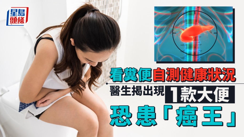 看糞便可自測身體狀況，出現1款大便恐患「癌王」。