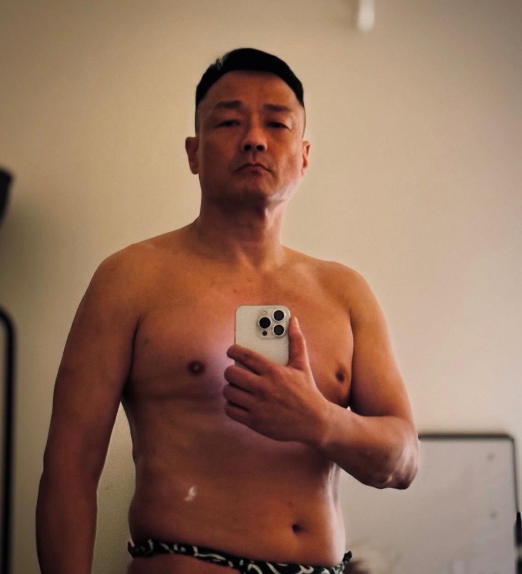 王喜驚爆患上急性腎衰竭。 王喜驚爆患上急性腎衰竭。