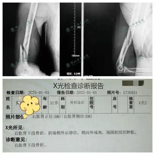 廣東壯男挑戰拗手瓜機械人，其中一名為31歲。 廣州日報