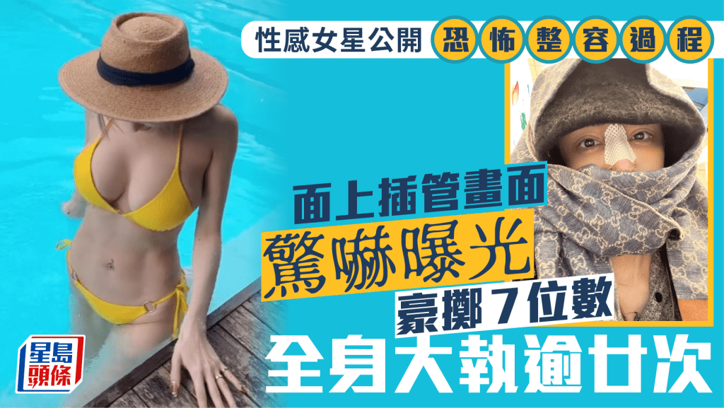 性感女星公開恐怖整容過程  面上插管畫面驚嚇曝光  豪擲7位數全身大執逾廿次