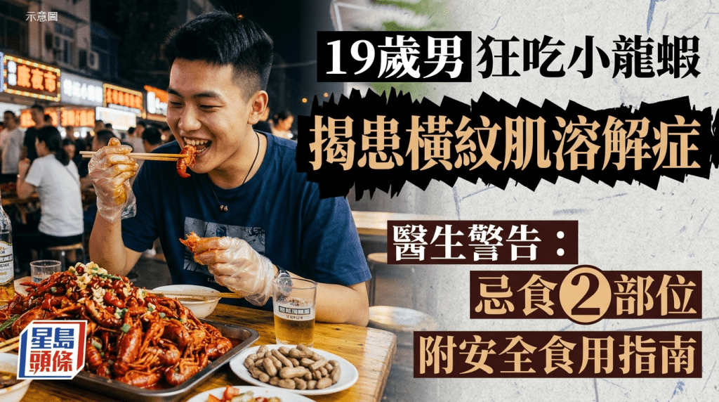  吃小龙虾要小心！19岁男吃后揭患横纹肌溶解症 医生警告忌食2部位 附安全食用指南