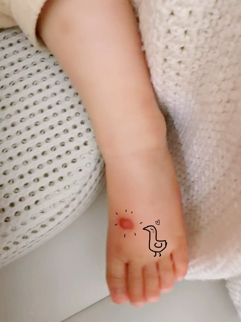「蕭哈哈」腳仔被蚊叮,黃翠如畫上流淚小鳥表達心痛。 「蕭哈哈」腳仔被蚊叮,黃翠如畫上流淚小鳥表達心痛。