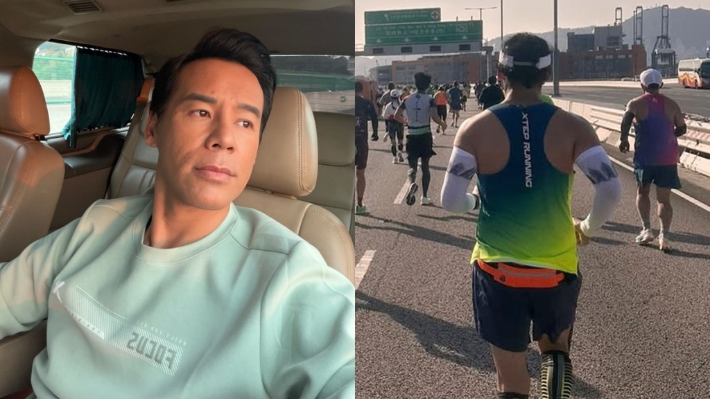 TVB男星徐榮肝臟出事屬「嚴重」程度  老婆曾提點面色差：我又唔肥又有運動都中？