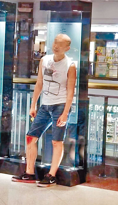 兇徒犯案後呆站現場。
