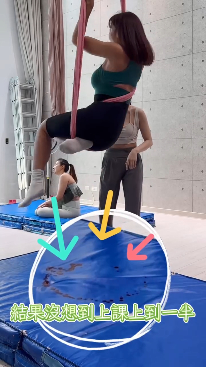 李宓做了腹部拉皮手術後走去做運動,中途突然傷口爆裂。 李宓做了腹部拉皮手術後走去做運動,中途突然傷口爆裂。