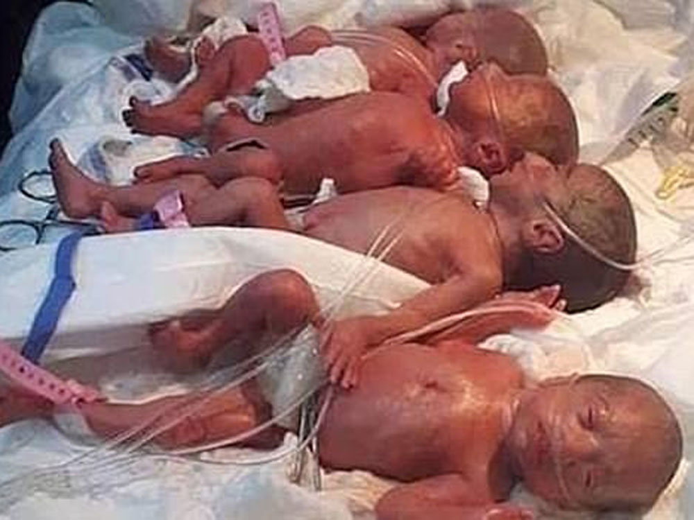 非洲馬里25歲產婦誕下九胞胎。（FB圖）