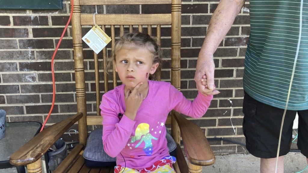 6岁女童左脸颊被子弹擦过受伤。 AP