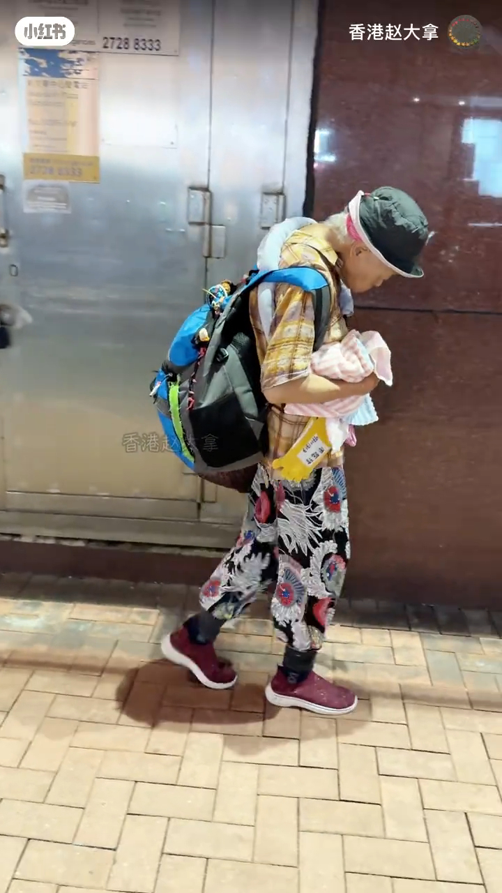 周聰玲因為駝背嚴重抬頭有困難。