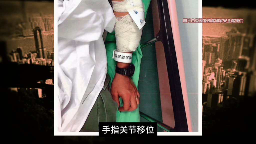 3名警員有不同程度的傷勢，包括手、腳和身體大範圍擦傷、手指關節移位等。